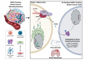 An illustration of how the PEAK1 gene can promote cancer metastasis and therapy resistance in aggressive HER2-positive breast cancers. Image courtesy of Jonathan Kelber.